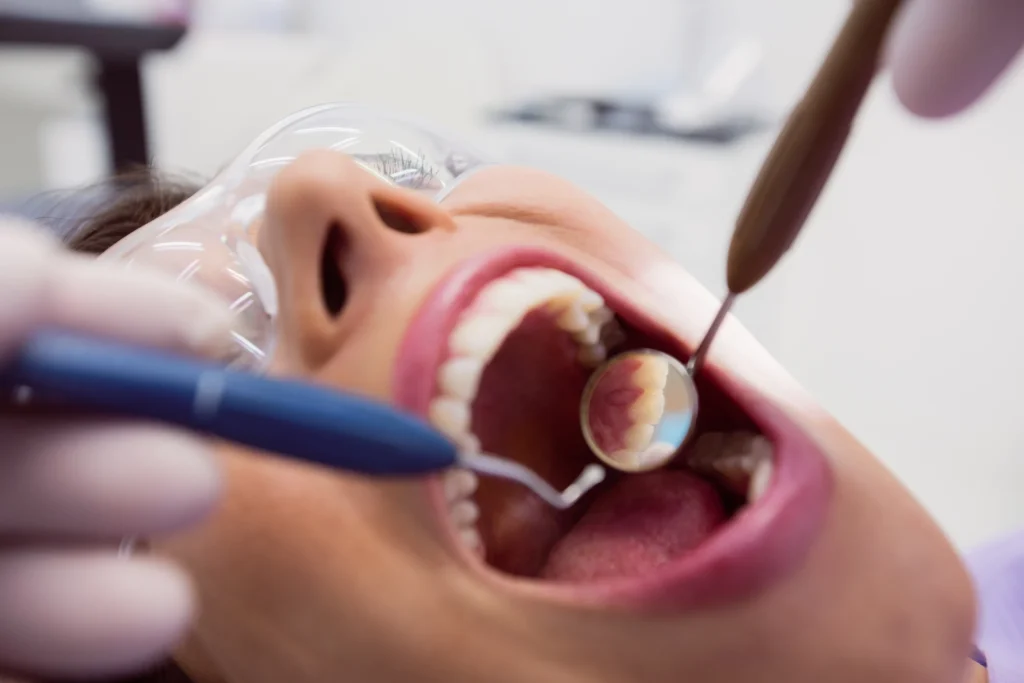 Kiedy udać się do periodontologa? Objawy chorób przyzębia, których nie wolno bagatelizować