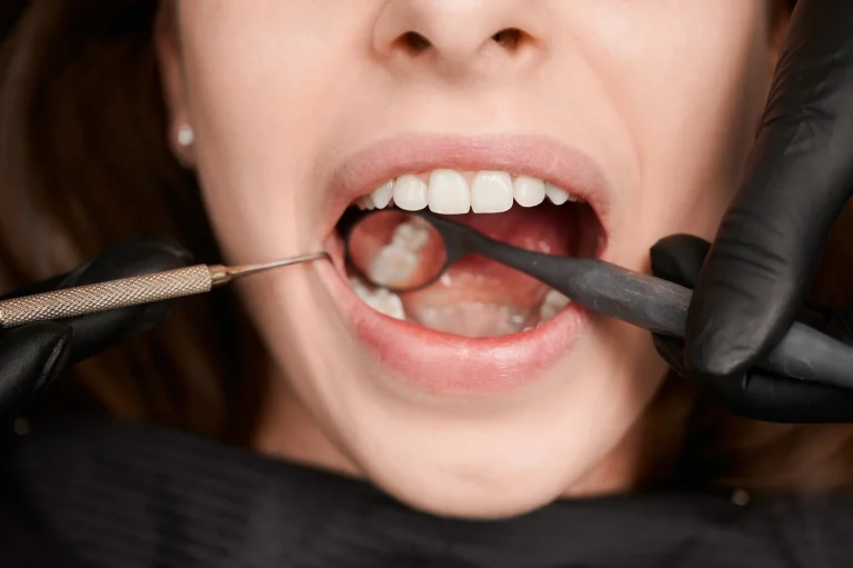 Krwawiące dziąsła: kiedy to sygnał, aby zgłosić się do periodontologa?